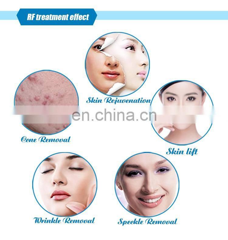 Facial resurfacing wrinkles removal portable rf cost of fractional co2 laser treatment machine