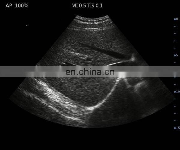 HC-A006B Full digital 15 inch Laptop Ultrasound machine with competitive price(ARM based)