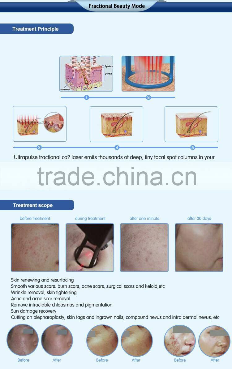 Most advanced high quality beauty equipment 10600 nm laser co2 surgical laser with USA tube