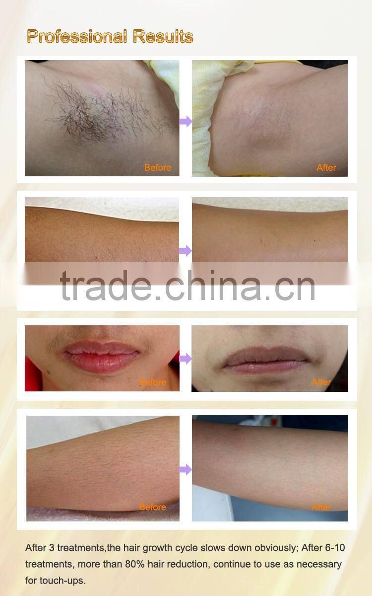 Professional 300,000 shots ipl flash lamp IPL machine ipl depilation machine for hair removal