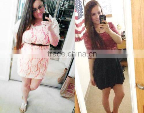 Liposonix HIFU for face and body slimming machine