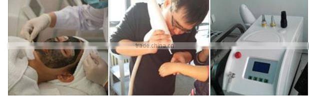 Portable Mini laser Q Switched ND:YAG best tattoo removal machine