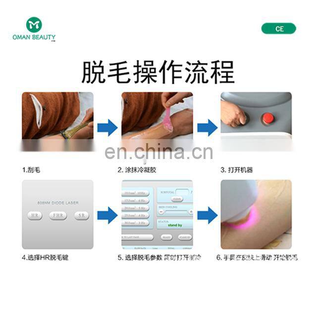 diodenlaser 808 lazer 808 hair removal machine diode laser diode laser dental 808 755 1064 laser 808 hair removal