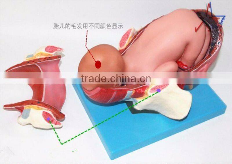 Training model of fetal production process in the model of term fetus