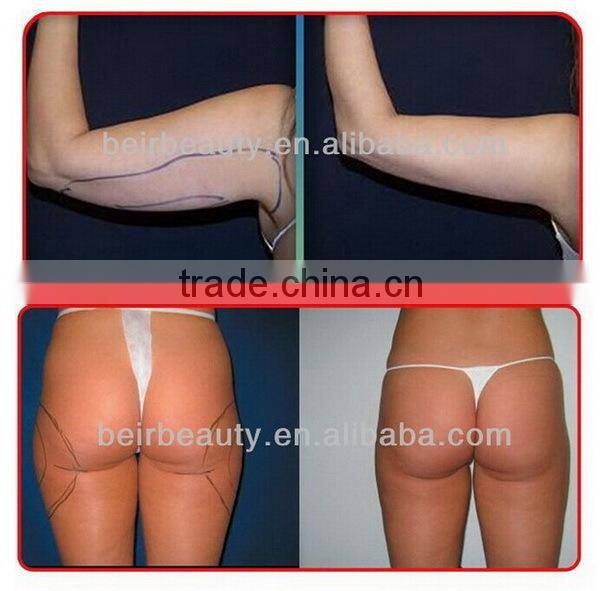 lipo laser / 408 diodes lipolaser slymming machine/ cold lipolaser diode slimming