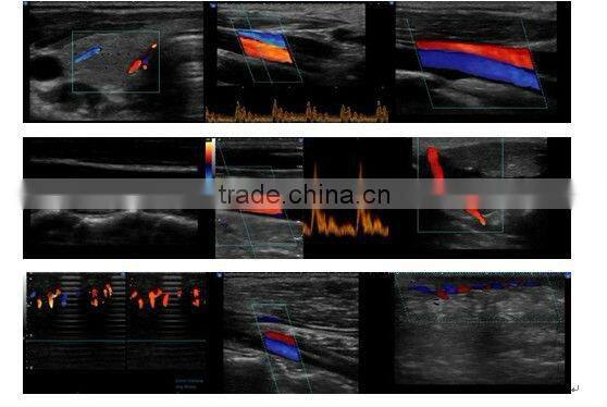 Abdominal/ Vascular/OB/GYN/4D Ultrasound iSpark 480 with CE Approved