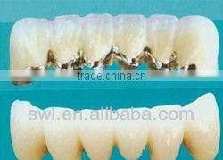 high quality laser spot soldering machine for repair dental Superwave Laser electric welding machine portable