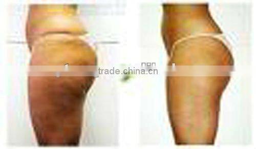 Promote tissue metabolism MED-360