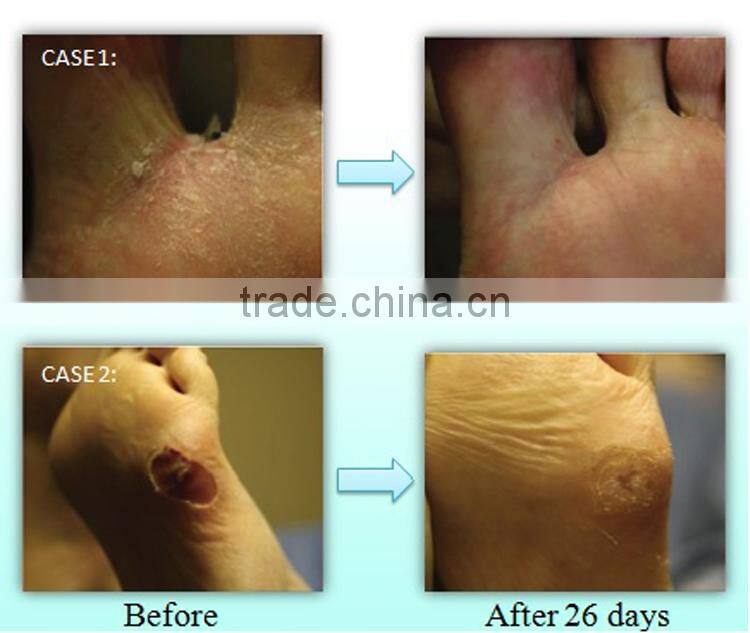 Copper Sole Extreme Athletic Crew Sock