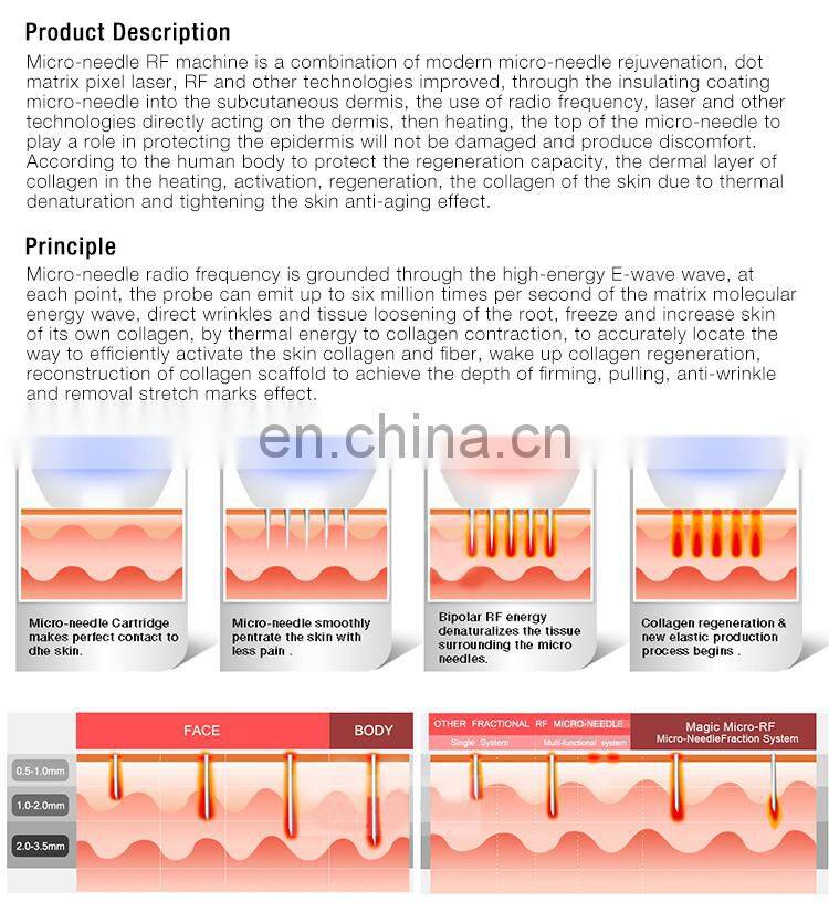 CE approved Special fractional magic effect face lift vertical fractional rf microneedle