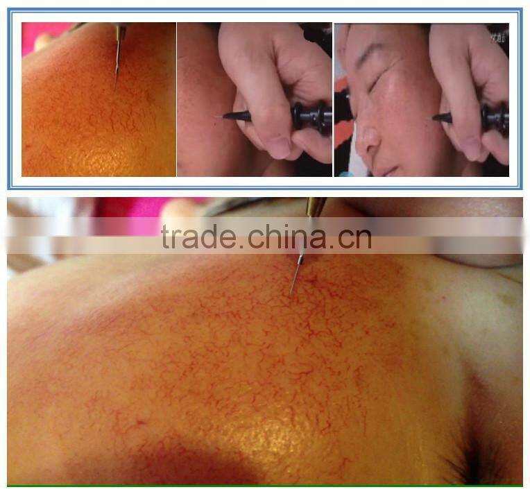 Pigmentation removal laser machine beauty salon equipment
