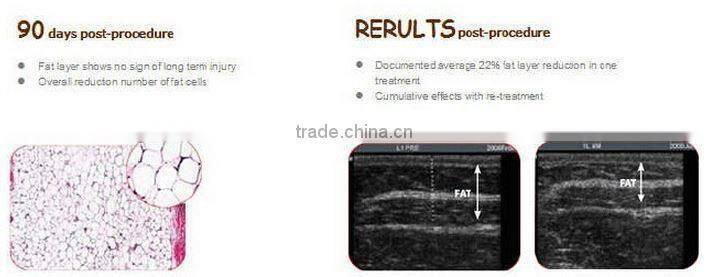 Newest beauty salon equipment sorisa beauty equipment