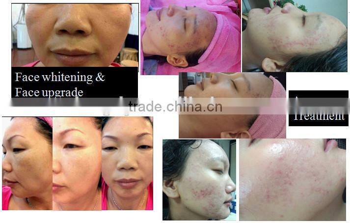 multifunction home use beauty machine for clean face, anti-aging, wrinkle removal
