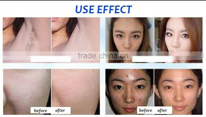 Topest OPT+Laser+Elight+RF Hair Removal For Four Functions with High Quality
