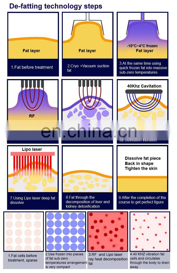 ultrasonic cavitation machine/portable cavitation machine/ultrasonic cavitation radio frequency machine