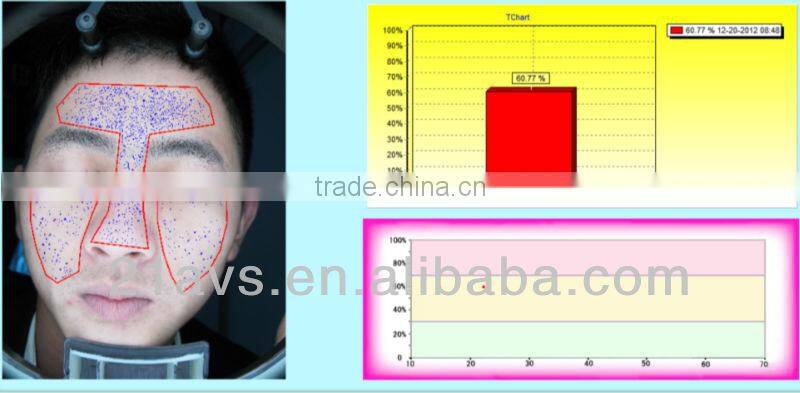 Professional Facial Skin Analyzer Magic Mirror with software system for beauty salon