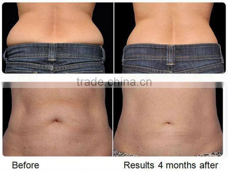 best 650nm lipo laser fat burning laser beauty machine