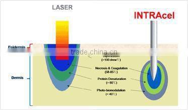 2014 Christmas Promotion!!! 2014 Newest fractional rf/fractional rf microneedle/rf fractional micro needle