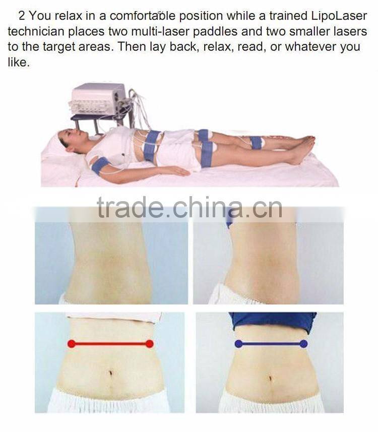 CE approval home use laser fat removal beauty equipment