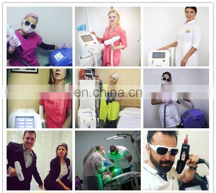 Long lifetime ND YAG Laser 1320nm 532nm 1064nm Laser Removal Tattoo Cost