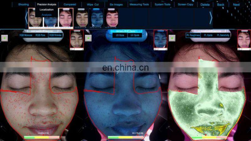 Sales 2022 Hot seal magic mirror facial UV Mositure tester Grease Wrinkle skin analyzer