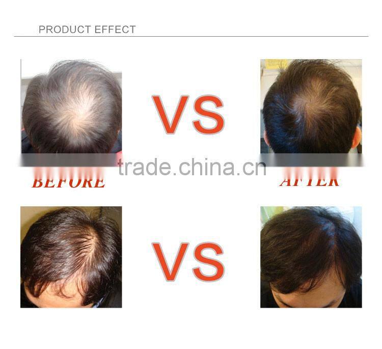 Private label natural best professional chinese herbal hair loss solutions