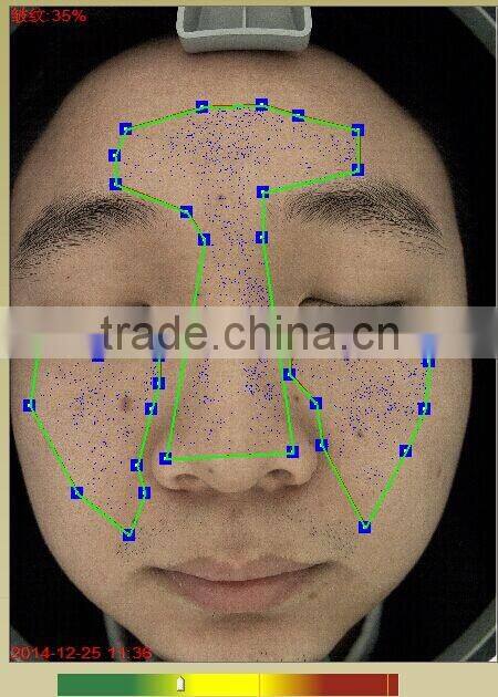AYJ-J009(CE)2016 Hot sale New Portable skin and hair analyzer system/skin analysis machine
