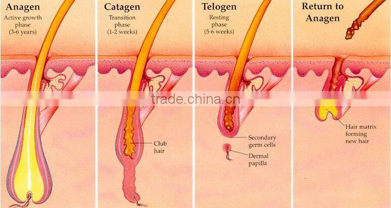 1800w diode laser marking machine for permanent hair removal