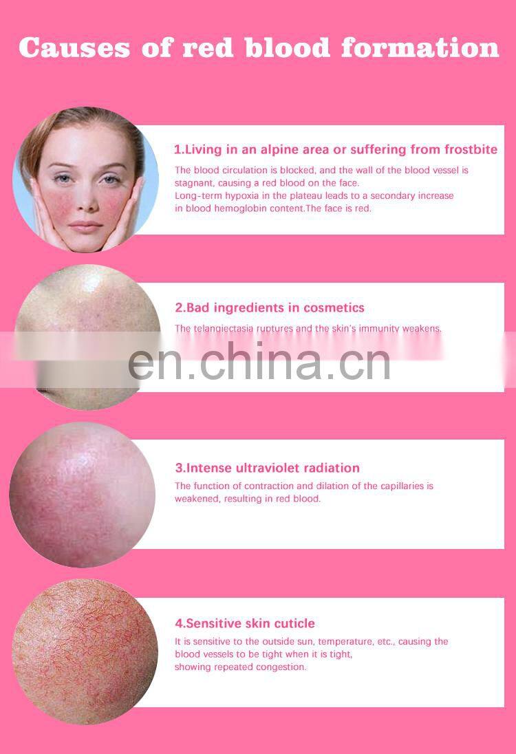 portable 980 diode laser vascular laser beauty equipment