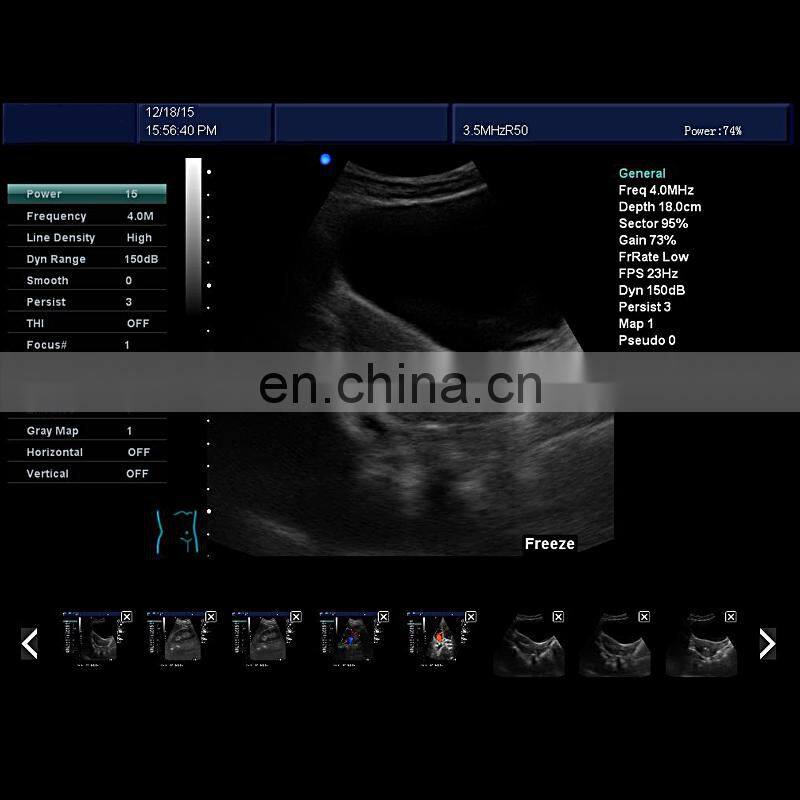 HC-A011 12 Inch High Resolution 128 elements Color Dopplor 3D 4D Ultrasound