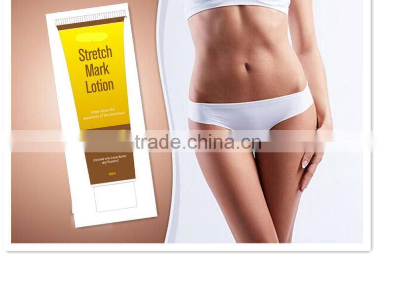OEM slimming cream, stretch mark cream