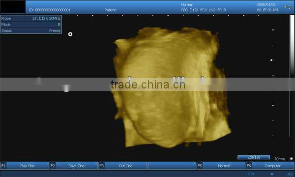 professional ultrasound devices with 3d