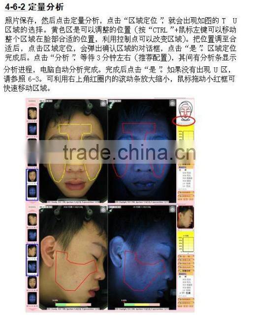 Excellent results!! skin scope analyzer, facial skin scope analyzer, skin scope magic mirror analyzer