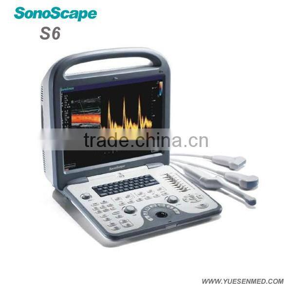 Mobile color Doppler system 3D 4D S11 Sonoscape echography