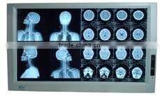 Coupon available! Double medical x ray view box with LED light, high quality (MSLXF11-N)