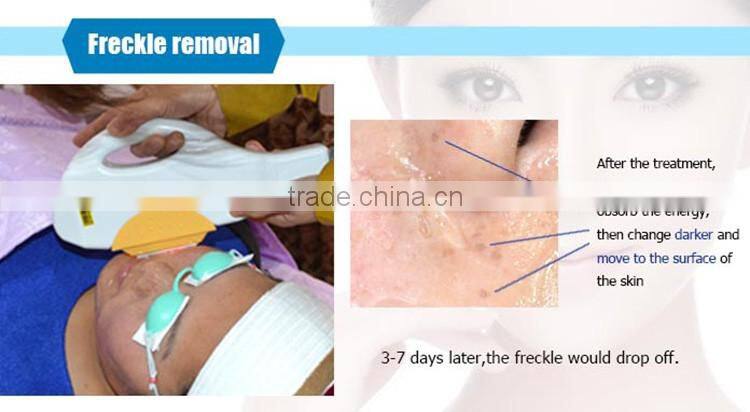 2016 New vertical no no hair removal ipl system for laser diodo 808