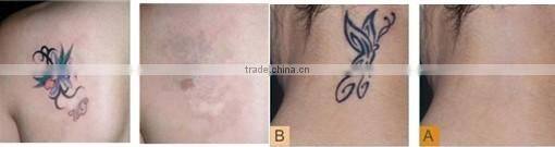 beauty ipl 2014 cheapest ipl machine price/multifunction laser beauty machine/shr ipl rf machine YH-III