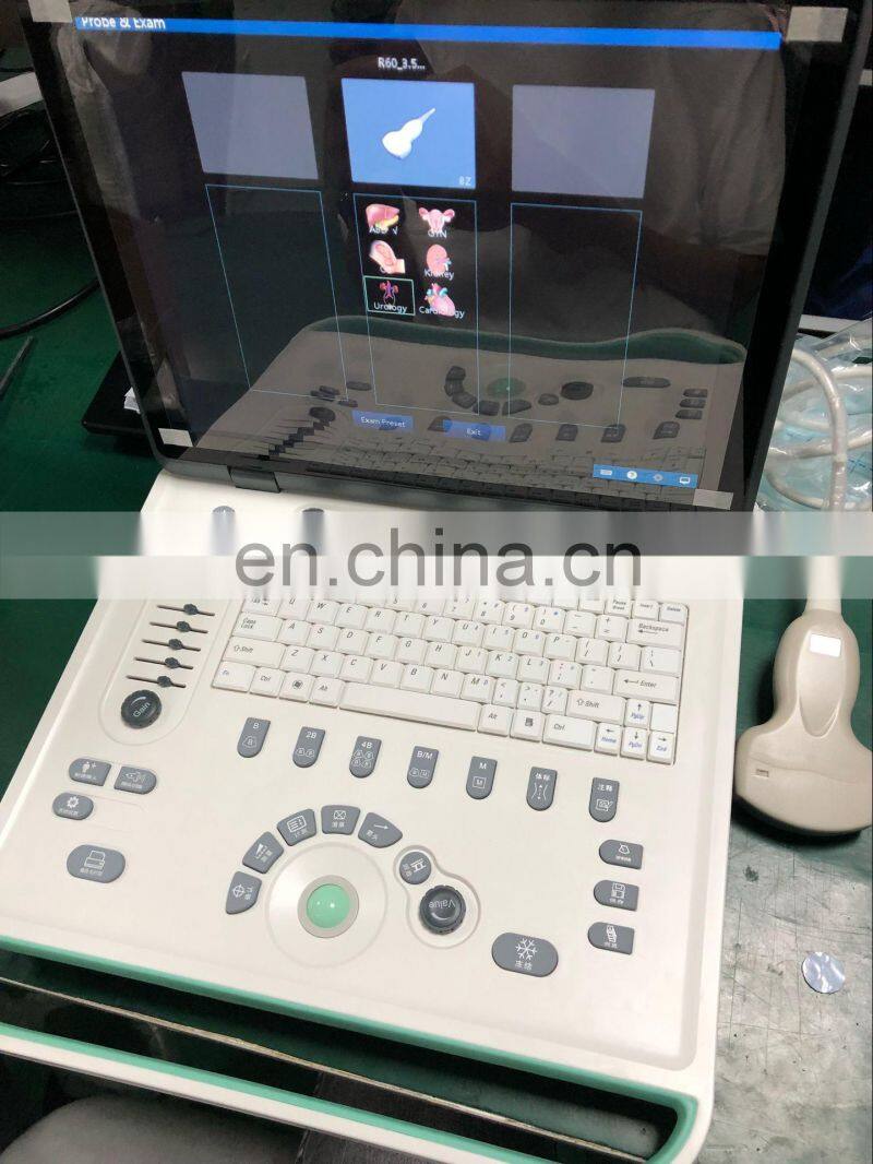 Medical diagnostic system cheaper Portable BW 3D 4D Live ultrasound Scanner Machine