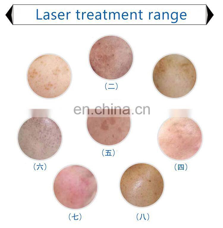 OPT ND YAG LASER RF Beauty Machine Elight Multi-functional Tattoo Removal Hair Removal