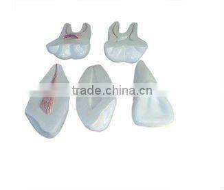 Enlarged model of teeth