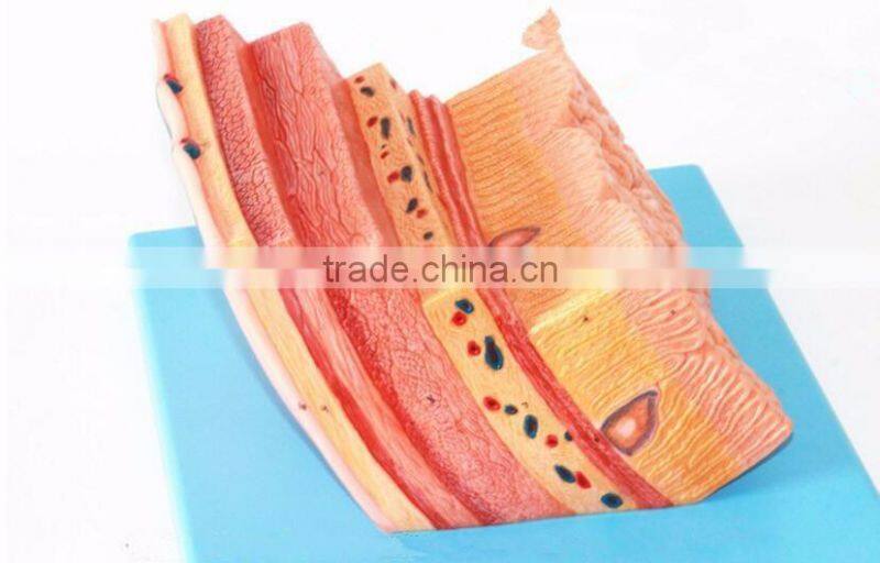 The human stomach amplification hierarchy model of gastric digestive department special amplification model