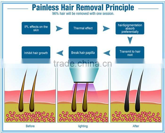 shr ipl machine / ipl shr laser / ipl shr hair removal machine