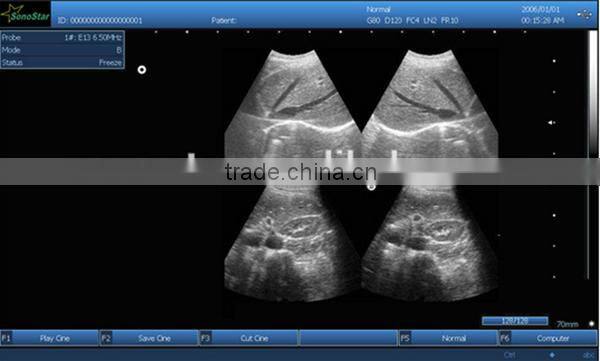 Sonostar hospital veterinary equipment B model ultrasound machine for sale V9