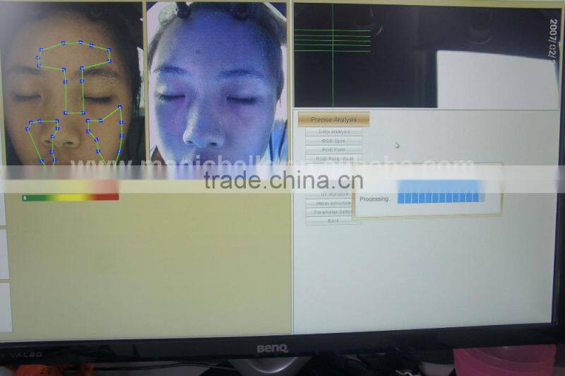 3D facial skin analyzer scanner dialysis machine analyzer machine