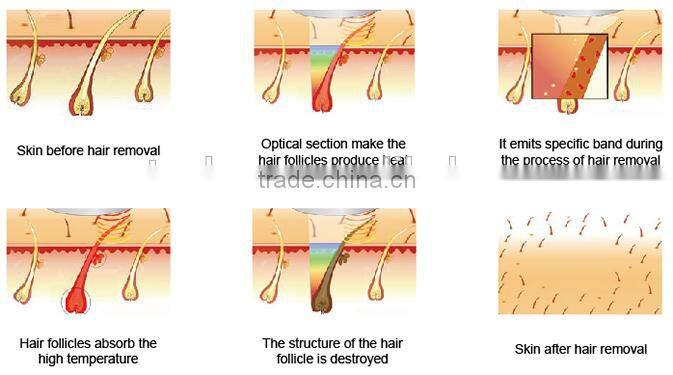 Portable 808 diode laser Beauty equipment from china for small business