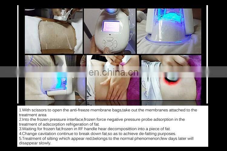 Cryolipolysis Machine For Home Use, Cryolipolyse Machine Portable