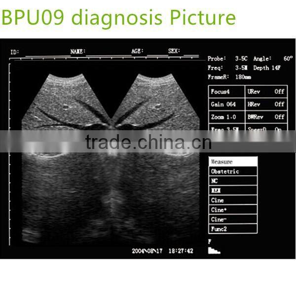 Portable Ultrasound Machine/Portable Ultrasound Scanner/Portable Ultrasound Manufacture Supplies- BPU09