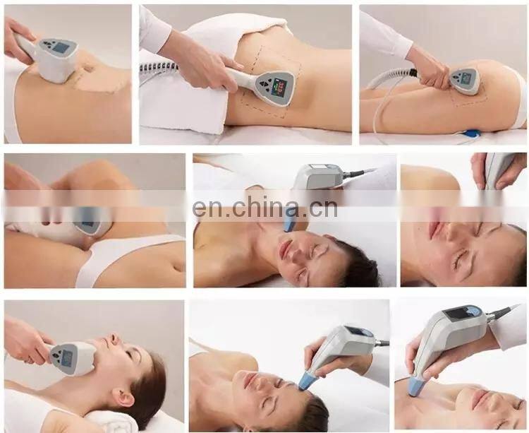 2 in 1 Vacuum cavitation system fat cutting Ultrasound RF weight loss machine