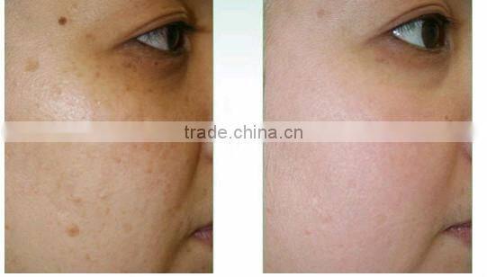 Oxygen Jet Type and CE Certification oxygen jet peel