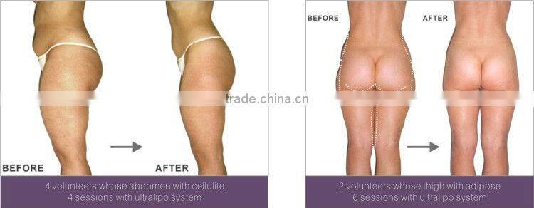 Hot!! Portable fat cavitation slimming machine S50(CE&ISO)lipo cavitation machine gel